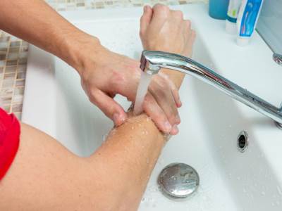  Šta raditi kad se opečete? Hladna voda nije uvek najbolje rešenje... 