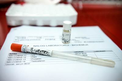  Nove mjere na snazi: Zabranjene svadbe, sahrane samo u krugu porodice 