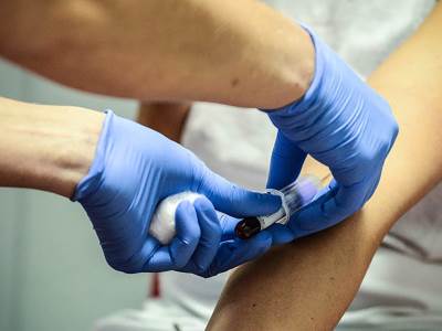  Nakon mesec dana borbe za život, izlečen krvanom plazmom! 