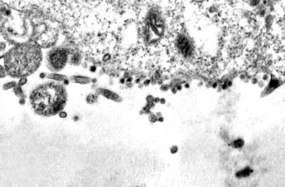  SNIMLJEN TAČAN TRENUTAK KADA VIRUS KORONE ULAZI U ĆELIJU I INFICIRA JE 
