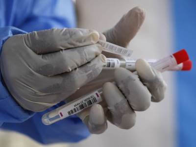  Na Kosovu drugi dan zaredom više izlečenih od novozaraženih 