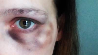  Bijemo žene? Mi? Ma ne...Predsednik Meksika tvrdi da nema porasta nasilja 