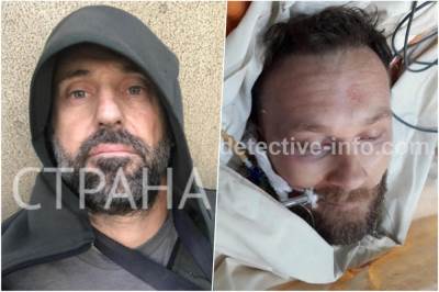  Ko je PECA PITBUL iz Niša koji ubija za crnogorske klanove 