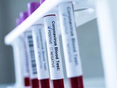  BRČKOVA DONACIJA GRAĐANIMA CRNE GORE , donira 11.200 brzih testova za otkrivanje koronavirusa 