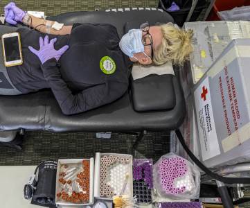  Korona izaziva OŠTEĆENJA MOZGA i kod onih sa umjerenom slikom! 