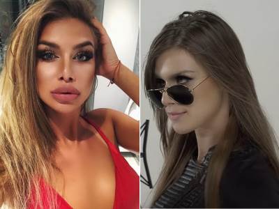  HAOS na društvenim mrežama: SEKSI Uraganka PRE PLASTIČNIH OPERACIJA! VIDEO 