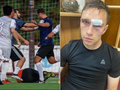  Roman-Sirokov-udario-pesnicom-sudiju-pa-ga-sutnuo-nogom-u-glavu-VIDEO 