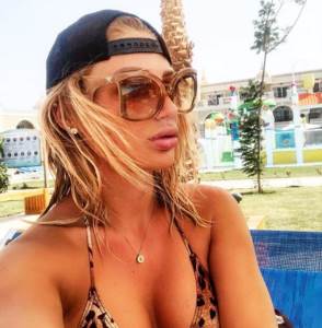  Milica-Kemez-nos-nakon-operacije-izgled 