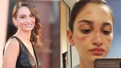  Italija-korona-virus-medicinska-sestra-licnost-godine-Mostra 