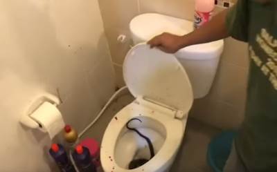  Zmija-iz-wc-solje-ugrizla-za-penis 
