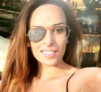  Dzesika-Notaro-decko-polio-lice-kiselinom-operacije-vid-kako-izgleda-danas-Venecija-crveni-tepih 