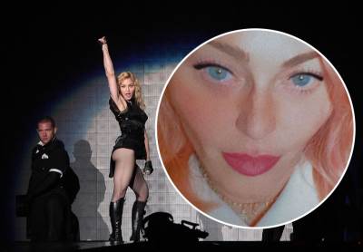  UPROPASTILA SE PLASTIČNIM OPERACIJAMA 