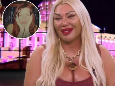  NEVEROVATNA TRANSFORMACIJA INSPEKTORKE IZ ZADRUGE: Pogledajte kako je Lili izgledala pre operacija! 