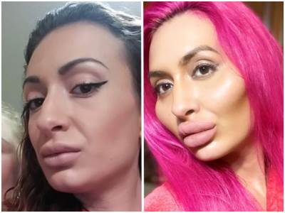  ŠOK FOTKE NAJRUŽNIJE ŽENE INSTAGRAMA 