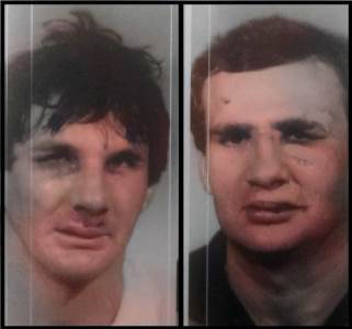  POGLEDAJTE NIKAD VIĐENE FOTOGRAFIJE PREBIJENIH GIŠKE I JOKSE: Ovako su izgledali poslije ČUVENOG OKRŠAJA u Podgorici! 