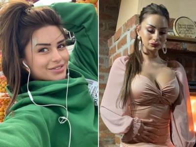  LEPOTICA SE UNAKAZILA PLASTIČNIM OPERACIJAMA: Proslavila se kao prodavačica na tezgi, sad ŠOKIRALA novim licem! (FOTO) 