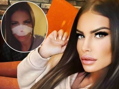  MALO BOTOKS, MALO HIJALURON, A ONDA 3.00O EVRA ZA NOVI NOS: Ovako je Dragana izgledala pre plastičnih operacija! (FOTO) 