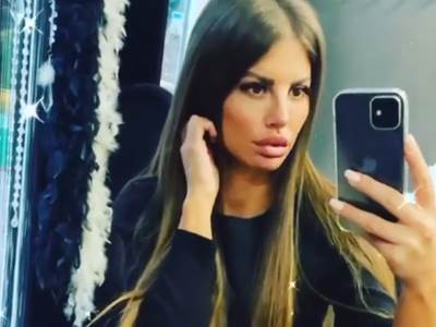  DRAGANA MITAR SKINULA ZAVOJE: Pokazala novi "bejbi nos" Pogledajte kako sada izgleda (FOTO,VIDEO) 