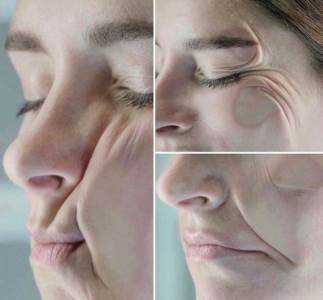  FOTKE KOJE SVI KOJI SPAVAJU NA BOKU TREBA DA VIDE: Pogledajte dobro šta radite svom licu 