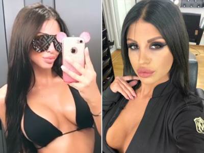  LJUDI SU NEPISMENI, NE ZNAJU RAZLIKU IZMEĐU INTERVENCIJE I OPERACIJE: Porede je sa Majom, a evo šta ona kaže na to! 