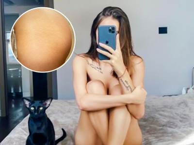  VRHUNSKA LEPOTICA RAZBILA MIT O SAVRŠENOSTI! Pokazala strije i ožiljke, žene kažu: HVALA TI! 