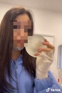  Pogrebnik otkrio da li se silikonin uklanjaju prije sahrane 