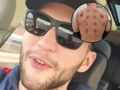  LEĐA MU PUNA CRVENIH PEČATA: Veljko Ražnatović zaprepastio objavljenom slikom, prizor uopšte nije prijatan! (FOTO) 