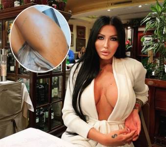  LEGLA NA STO I PODIGLA SUKNJU: Bivši uhapšen, ona šara zadnjicu - nova tetovaža Tijane Ajfon! (FOTO) 