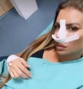  NIJE ZADOVOLJNA NOSEM OD 3.000 EVRA: Dragana Mitar ponovo otišla "pod nož"! Otkrila detalje nove int 