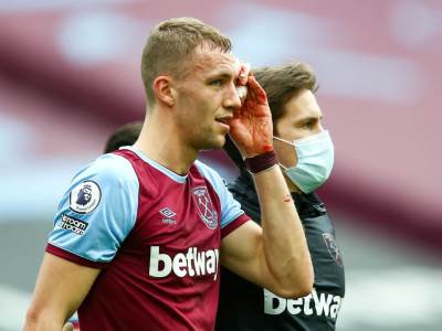  KRVAVA MU CELA FACA, A ON HOĆE DA IGRA: Zvezda Vest Hema kao da je od kamena 