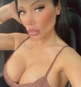  tamara djuric porse instagram silikoni 