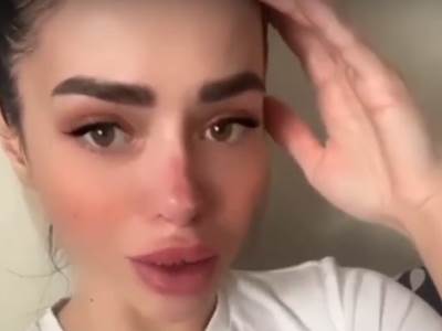  Anastasija Balinskaja rijaliti slike nakon operaciji 