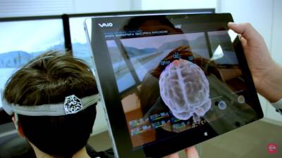  naucnici na pragu otkrica za paralizu 