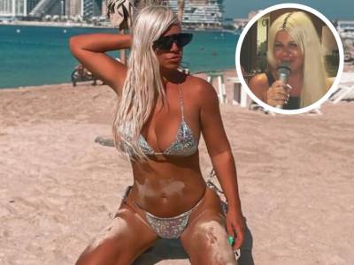  DARA BUBAMARA SA I BEZ FOTOŠOPA! POKAZALA PRAVO LICE 