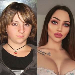  DALA 35.000 EVRA ZA PLASTIČNE OPERACIJE I PROMENILA LIČNI OPIS: Starleta prije i posle 