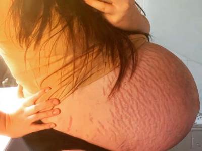  druga najveca zenska beba na svijetu velika britanija 