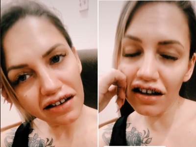  sanja stojanovic operacija usana 