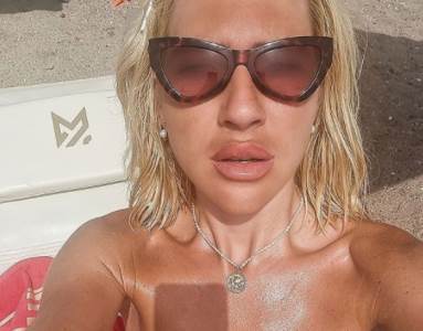  jovana jeremic estetske korekcije 