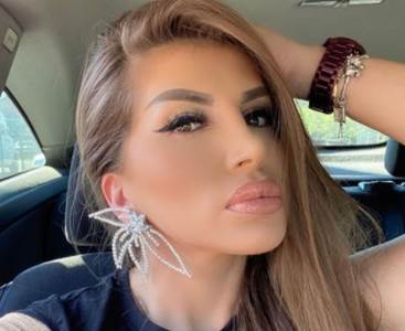  poznati koji su vadili silikone iz usana  