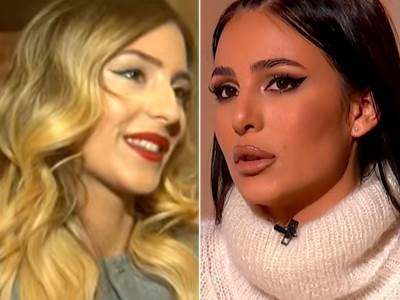  anastasija raznatovic prije operacija 