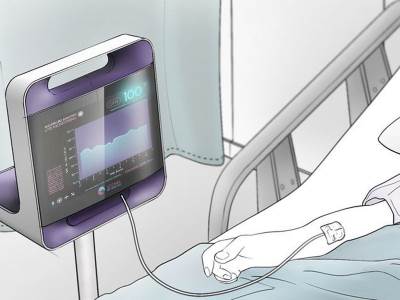  Accunea Transplant Monitor aplikacija za transplataciju organa 