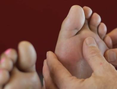  hladne noge cirkulacija zacepljene arterije 