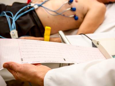  kako sniziti los holesterol 