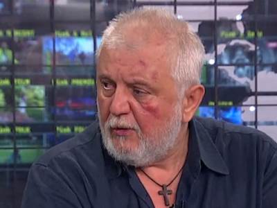  gaga antonijevic modrice nakon tuce sa bjelogrlicem  