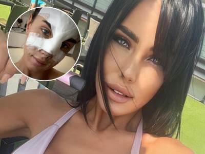  prozivali je da je plastična aleksandra subotić 