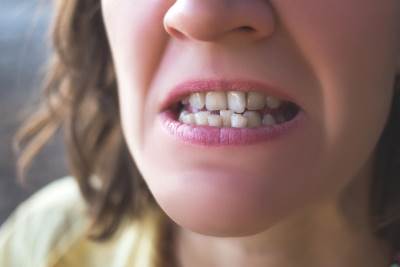  krivi zubi opasni po organe za varenje 