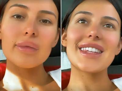  anastasija ražnatović bez trunke šminke 