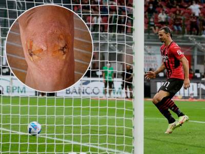  zlatan ibrahimovic objavio sliku koljena 