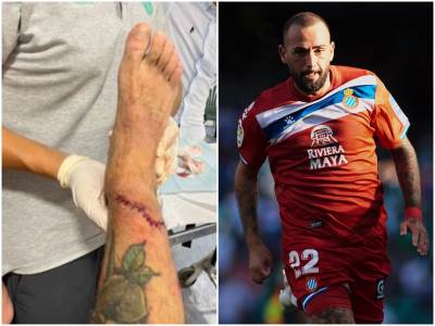  Aleiš Vidal povreda 