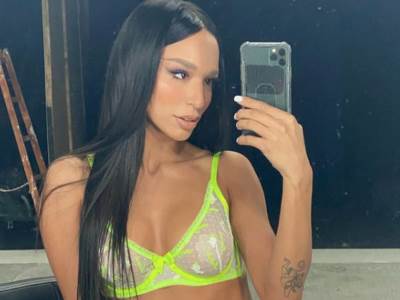  Edita Aradinović o estetskim korekcijama 